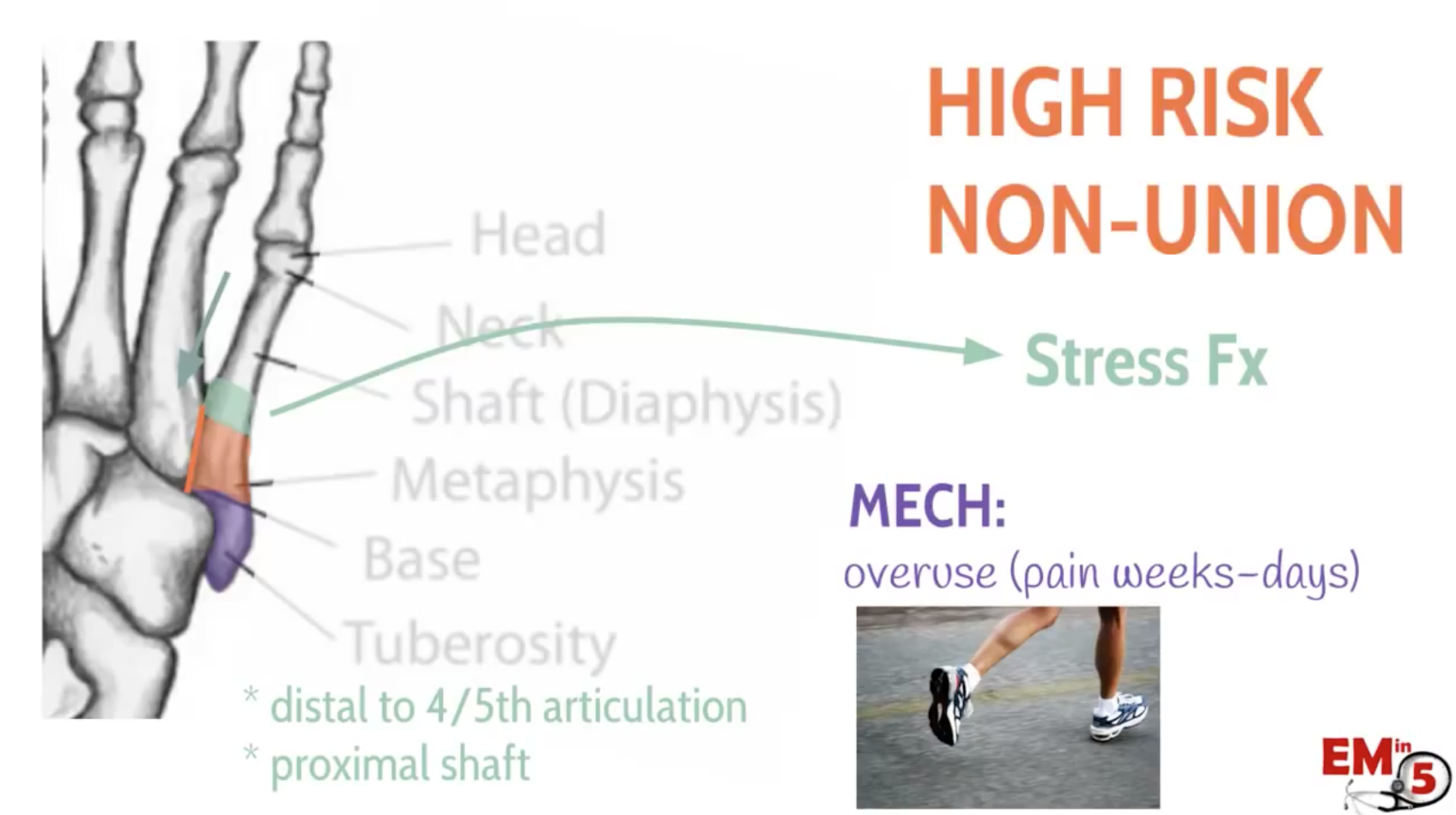 Emdocs Net Emergency Medicine Educationem In Th Metatarsal Fractures Emdocs Net