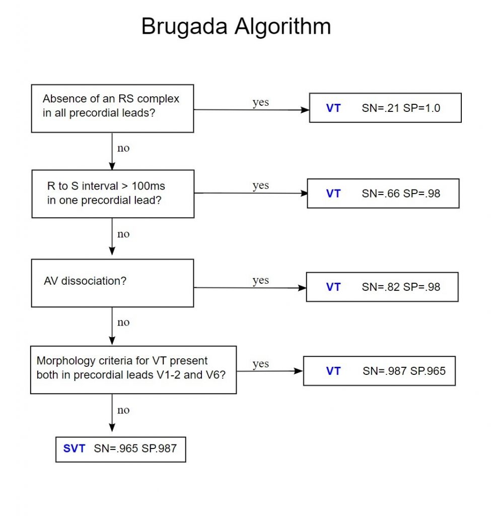 EmDOCs Emergency Medicine EducationBrugada Algorithm EmDOCs Emdocs emergency medicine educationbrugada algorithm emdocs