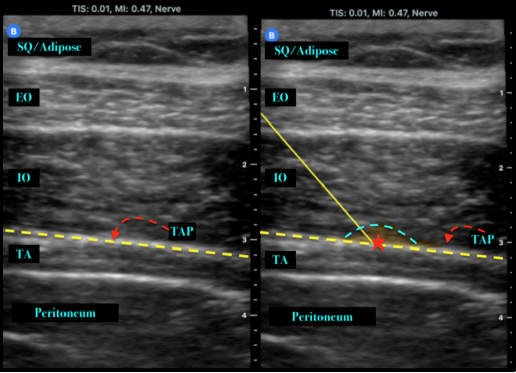 Emergency Medicine EducationPain Profiles ‘TAP IN