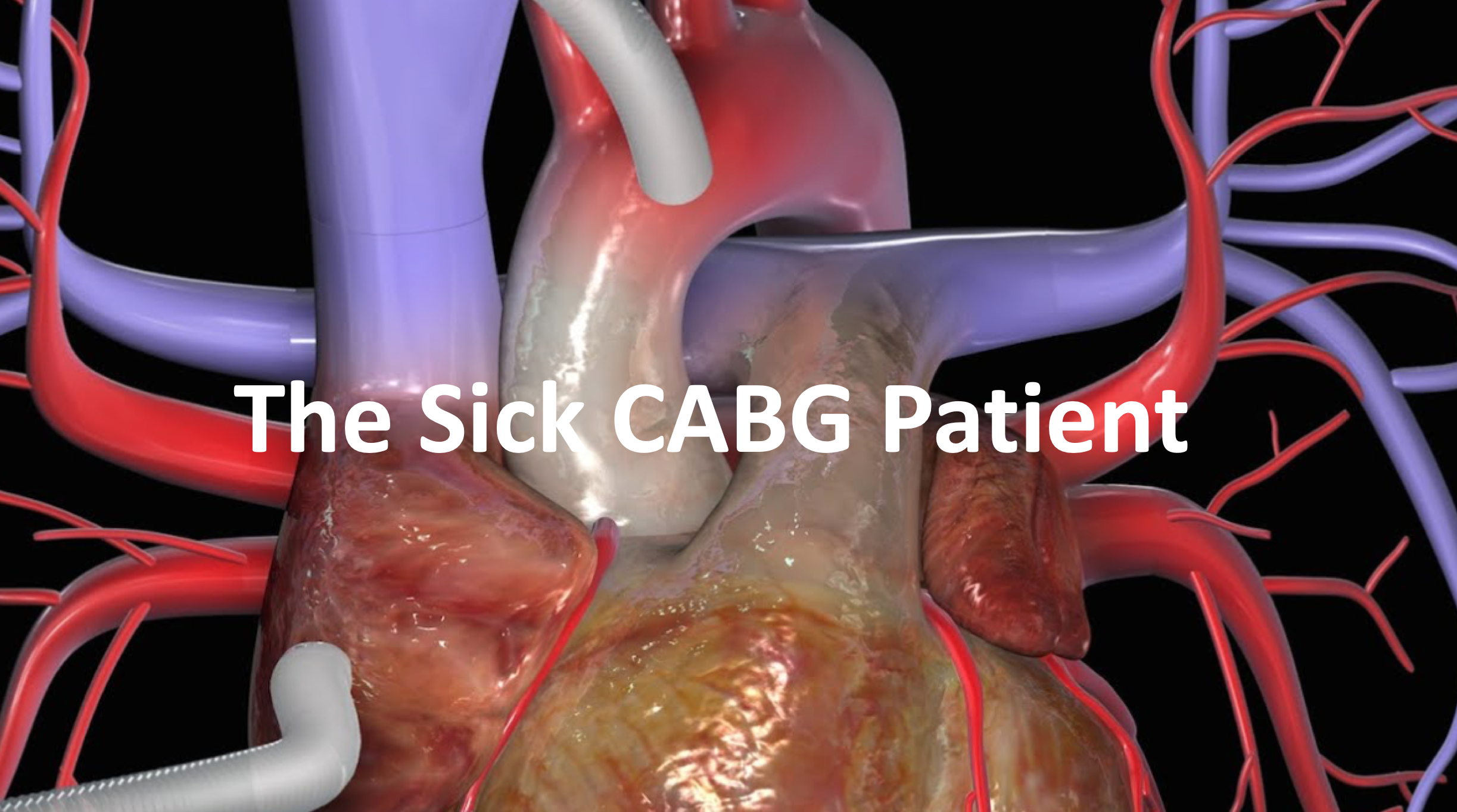 Emdocs emergency medicine educationpractice updates archives