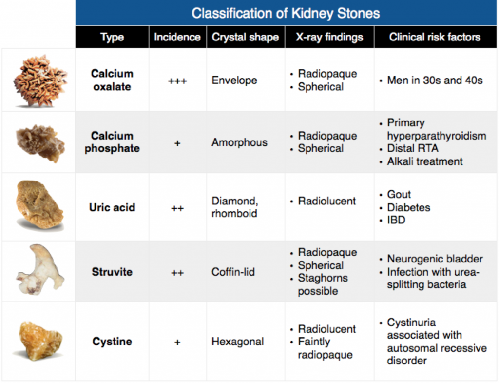 Emergency Medicine EducationEM3AM Urolithiasis emDOCs
