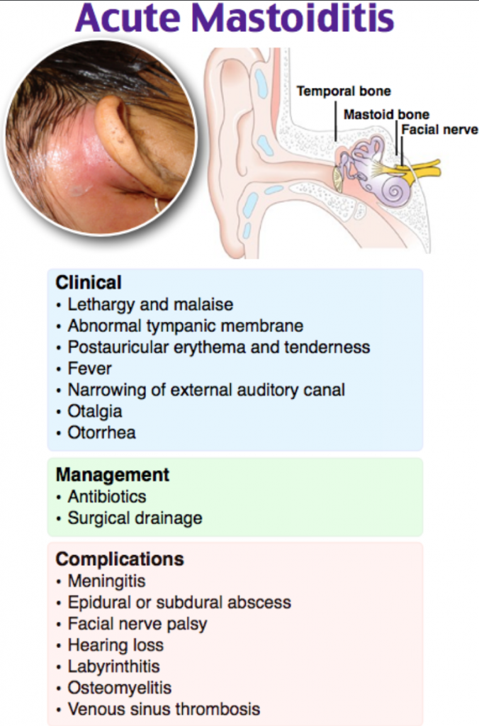 EM@3AM: Mastoiditis - emDocs