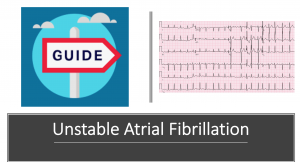 Unstable atrial fibrillation header
