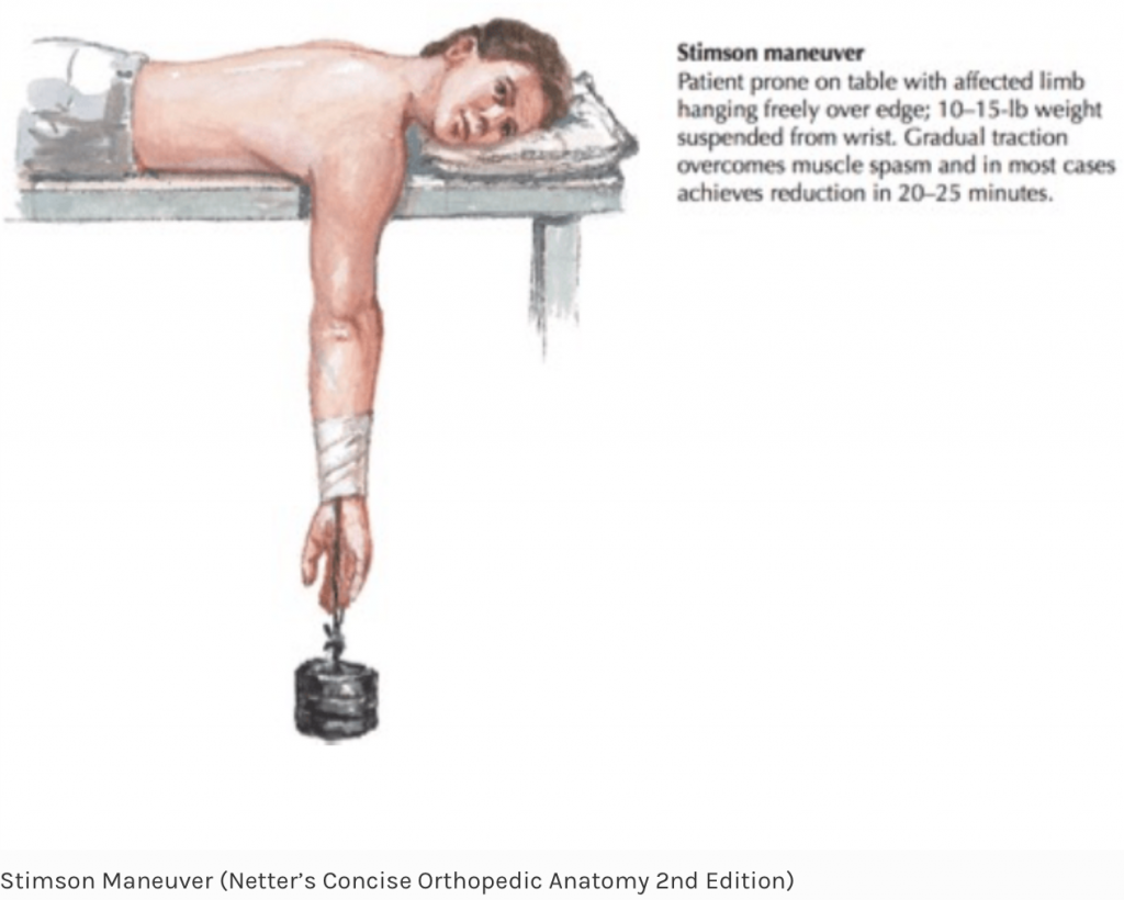 Emergency Medicine EducationEM3AM Anterior Shoulder
