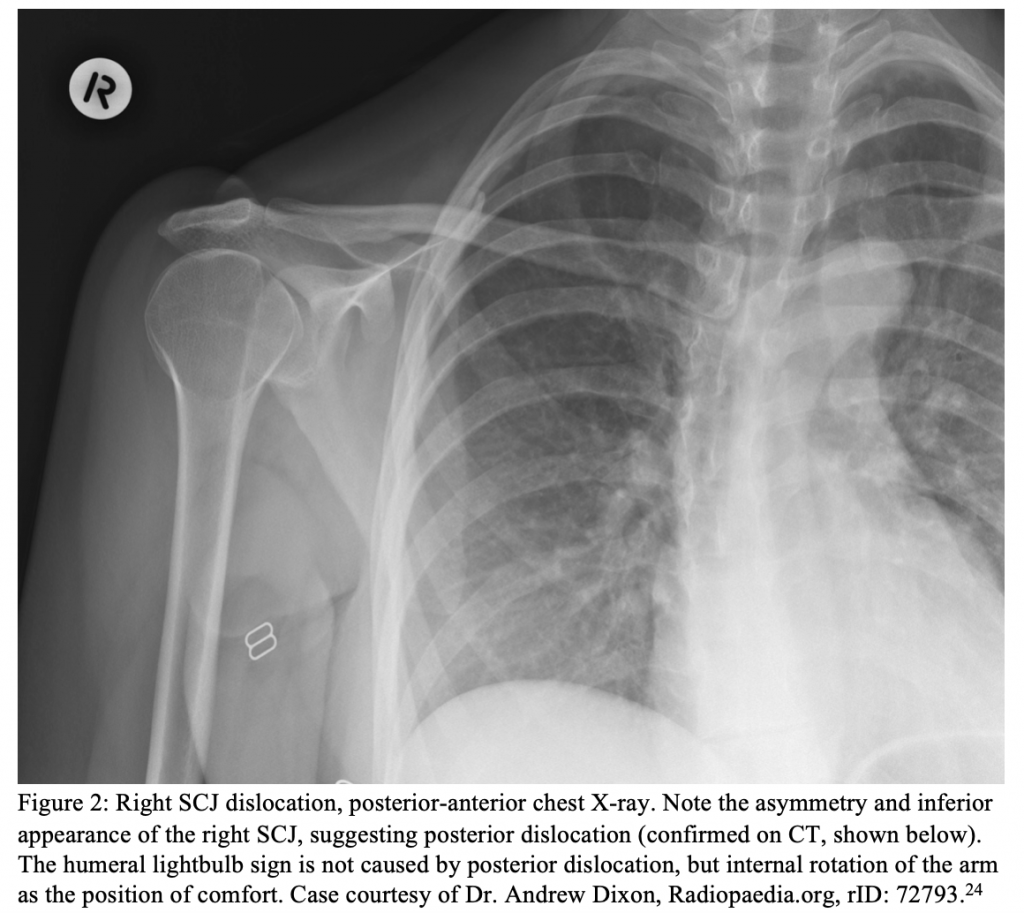 EmDOCs Emergency Medicine EducationScreen Shot 2020 05 13 At 9 35