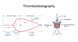 TEG thromboelastography illustration