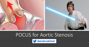 POCUS for aortic stenosis header