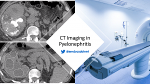CT imaging in pyelonephritis header