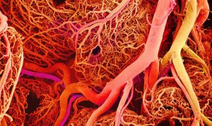Image of blood vessels