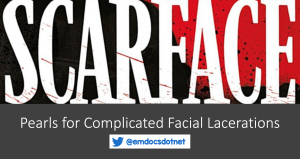 pearls for complicated facial lacerations header