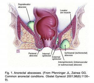 emDOCs.net – Emergency Medicine EducationAnorectal Abscesses: ED Clinical  Presentation, Evaluation, and Management - emDOCs.net - Emergency Medicine  Education