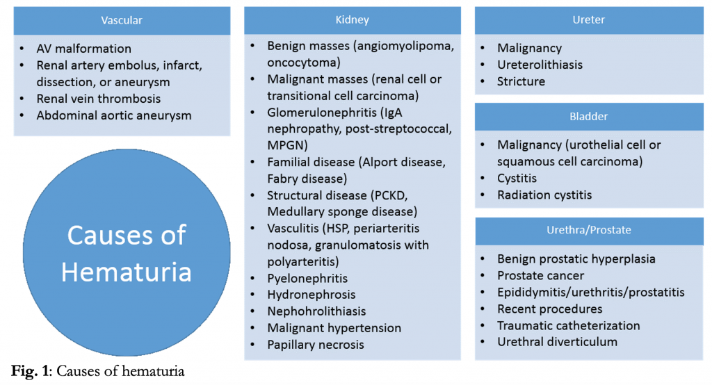 Evaluation and Management of Hematuria in the Emergency Department - emDocs