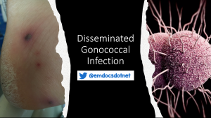 Disseminated gonococcal infection header