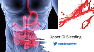 Upper GI bleeding (UGIB) header