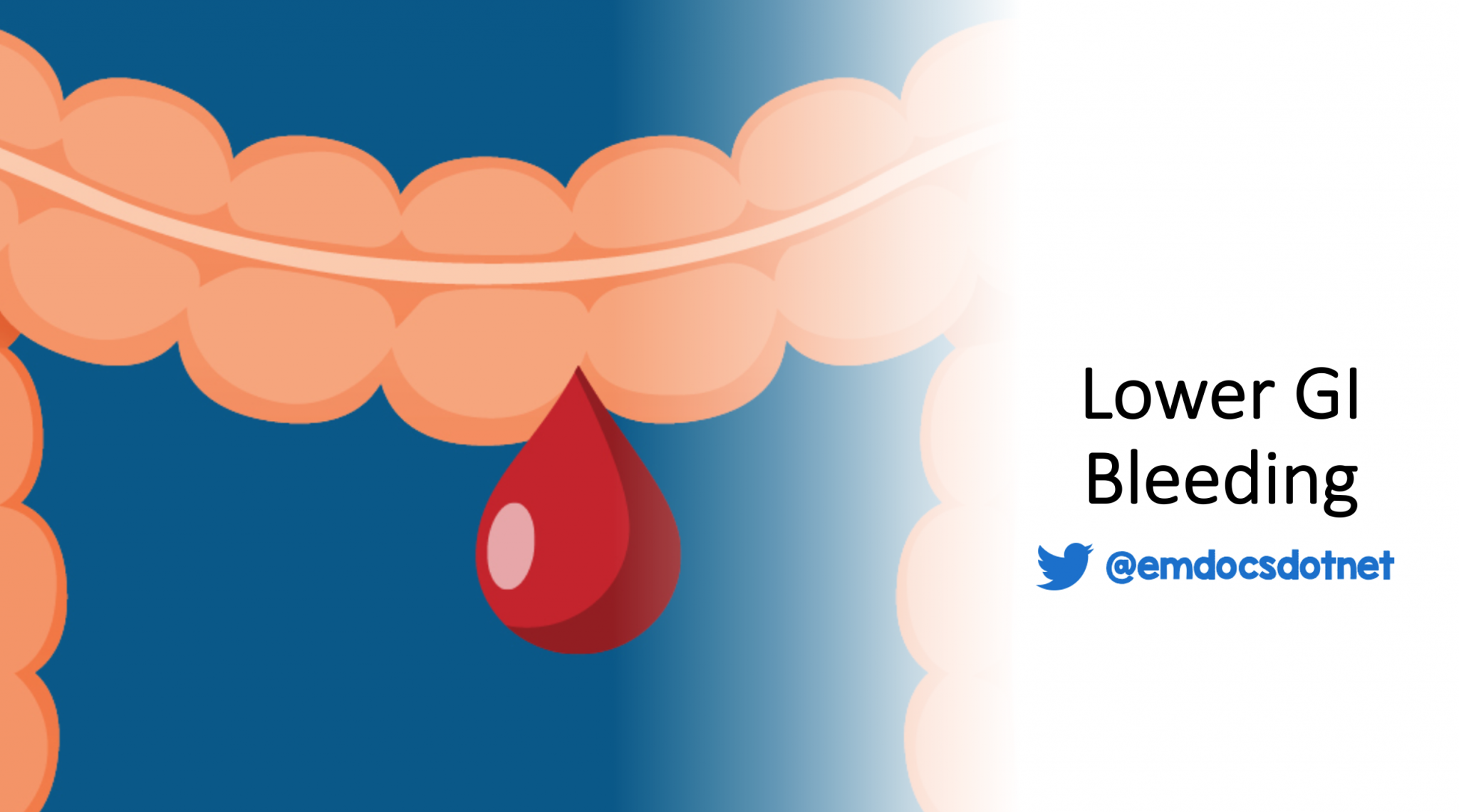 Lower Gastrointestinal Bleeding: Evaluation, Management, and ...