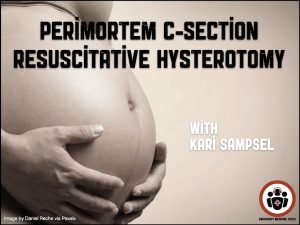 Resuscitative hysterotomy Emergency Medicine Cases