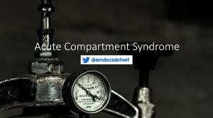 Acute compartment syndrome header