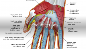 Hand infections header