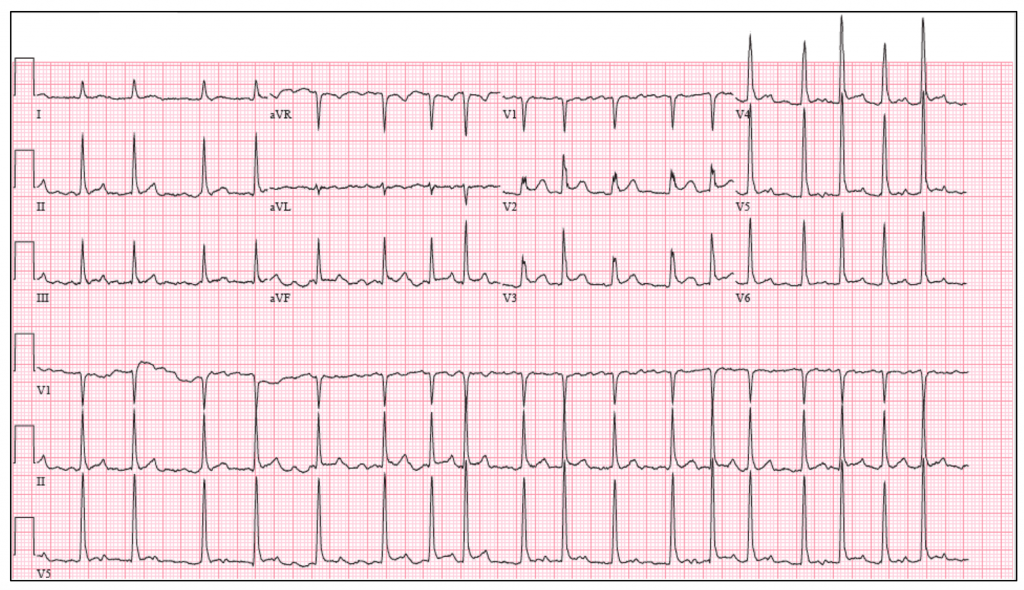 Emergency Medicine EducationElectrical cardioversion in