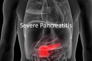 Severe pancreatitis header
