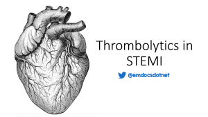 Thrombolytics in STEMI header
