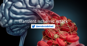 Transient ischemic attack (TIA) header