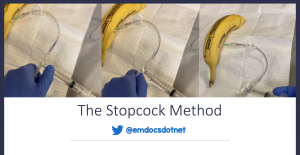 The stopcock method header