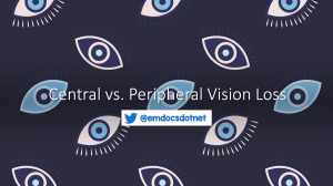 Central vs. peripheral vision loss header