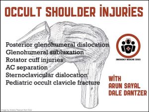 Occult shoulder injuries Emergency Medicine Cases