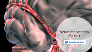 Neurointervention for LVO header