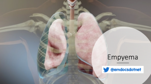 Empyema header