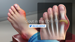 Gout in the ED header