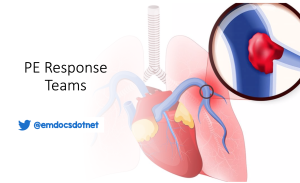 Pumonary embolism response teams PERT header