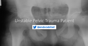 Unstable pelvic trauma header