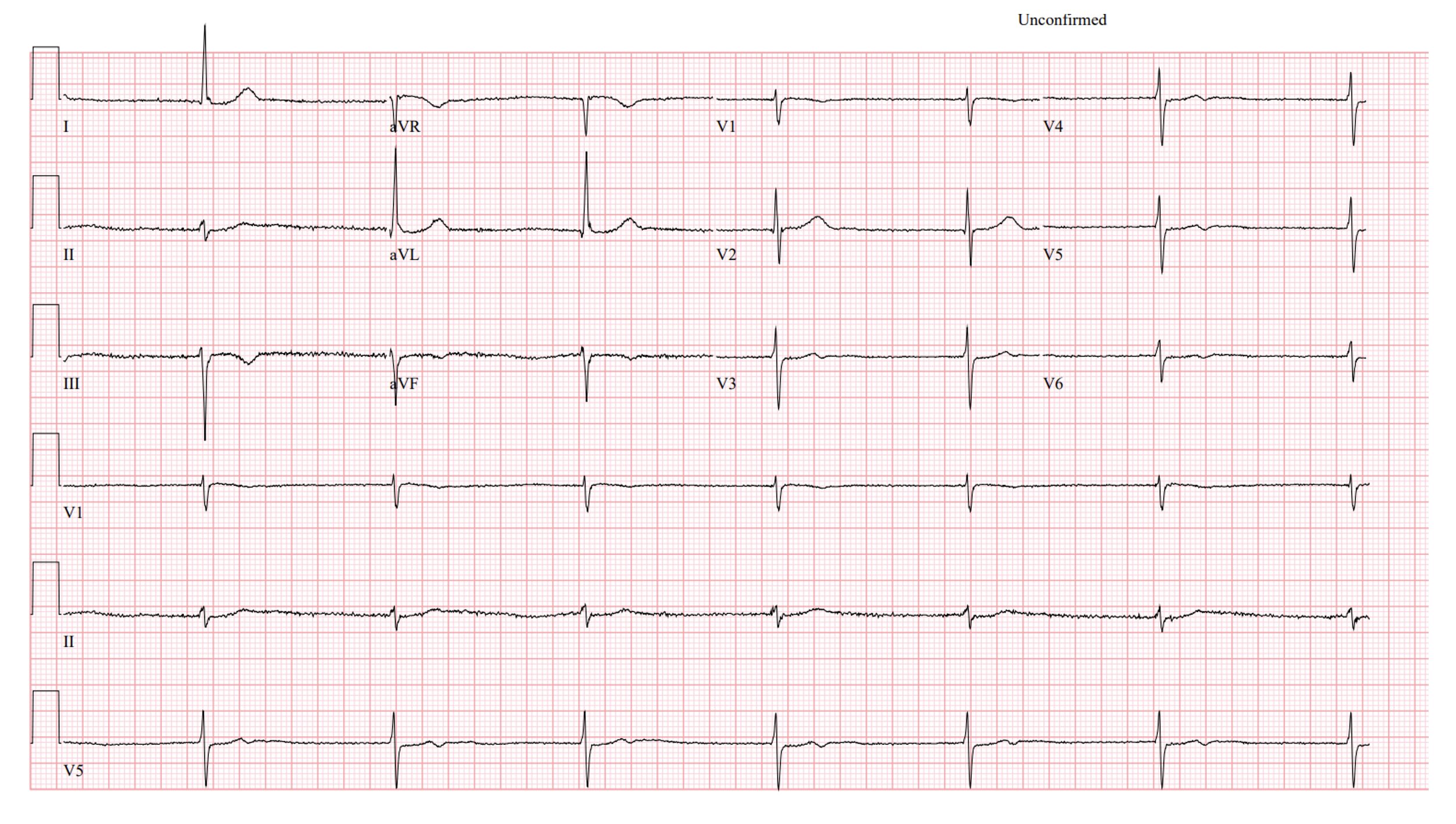 ECG PH 5510 Slow Rider, spaarpot