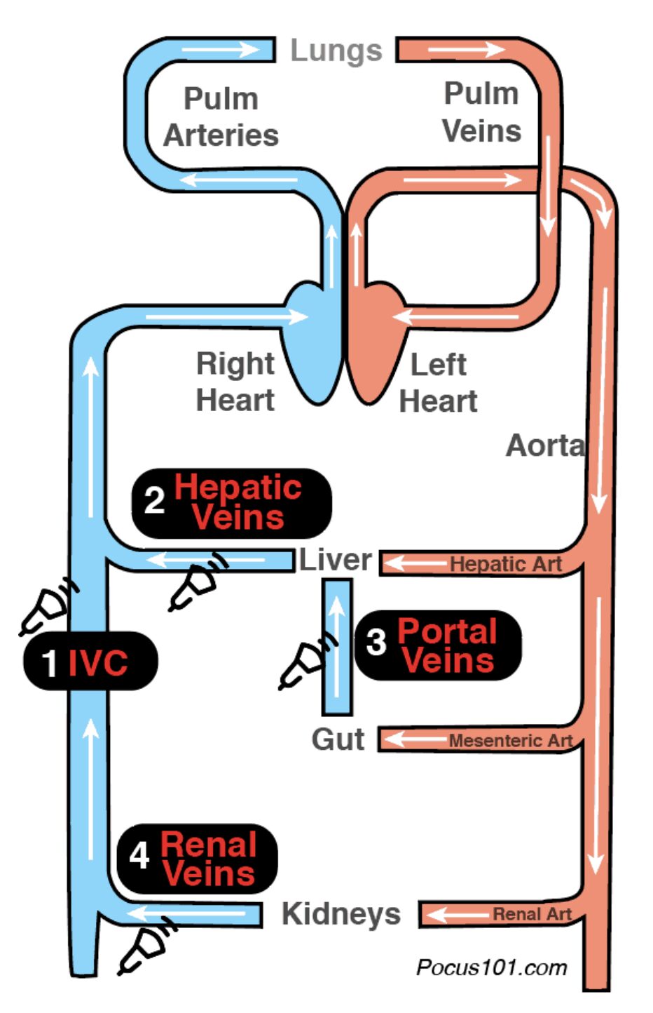US Probe: Assessing Venous Congestion - The VExUS Approach - emDocs