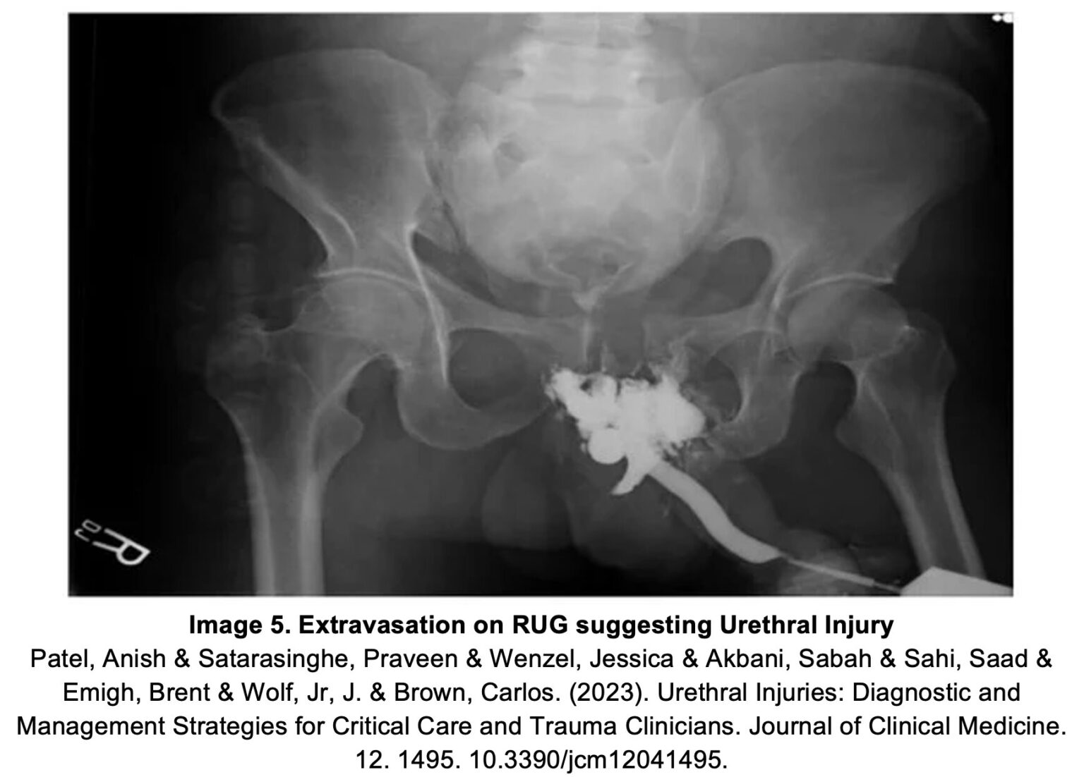 EM@3AM: Genitourinary Trauma - emDocs