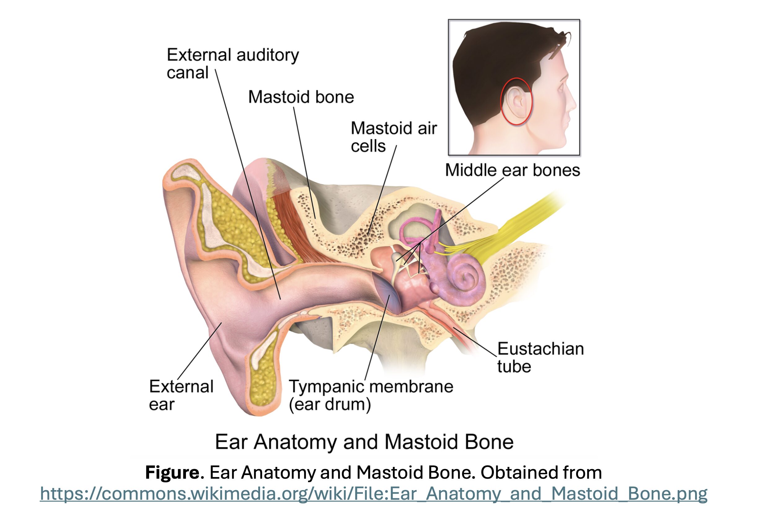 mastoiditis anatomy