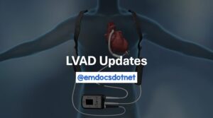 LVAD Image