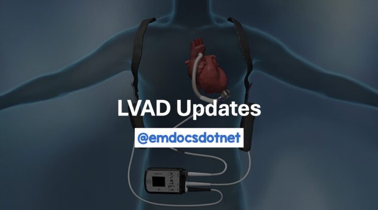 LVAD Image